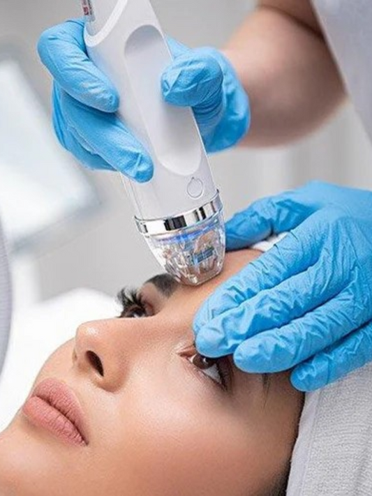 Secret RF Consultation
