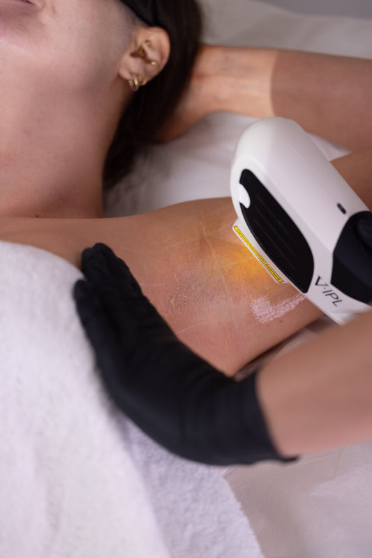 IPL Hair removal