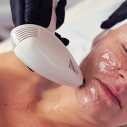 Viora Non Surgical Face Lift