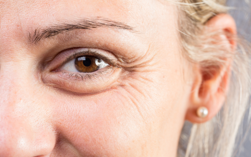 Anti-Aging
