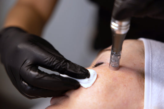 AMESON Micro-needling